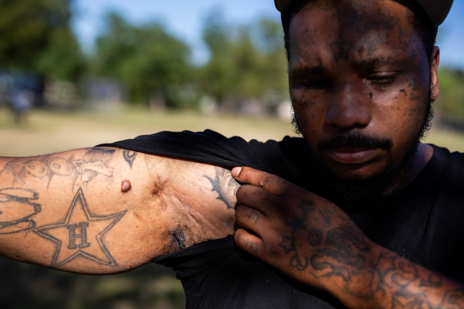 A close-up of a person showing their tattooed arm and underarm, with visible scars and various tattoos, set against a blurred outdoor background.